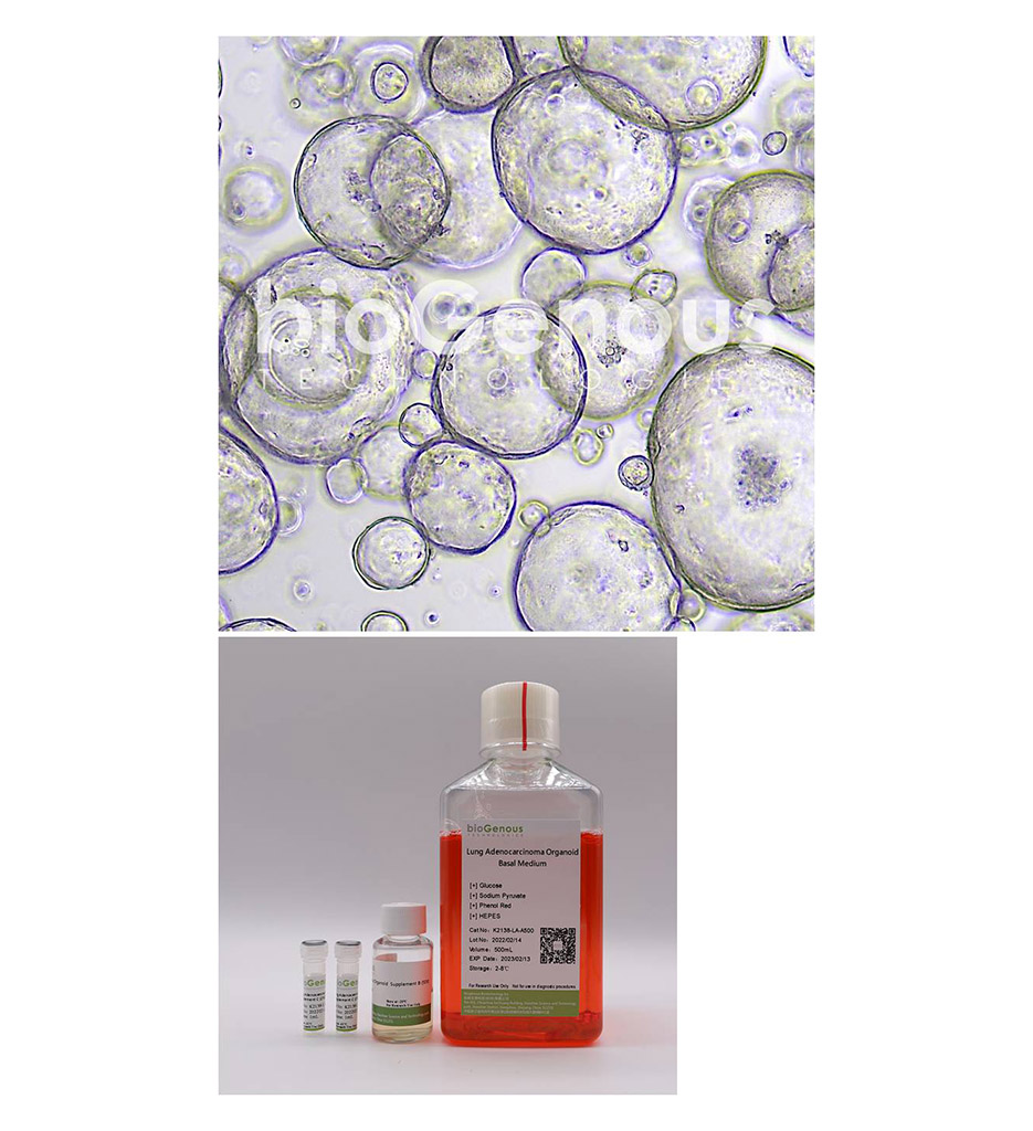 Lung Adenocarcinoma Organoid Kit肺腺癌