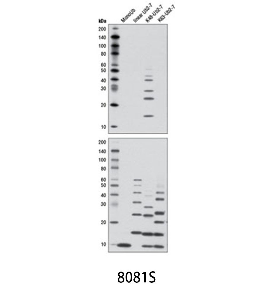 K48-linkage Specific Polyubiquitin (D9D5) Rabbit mAb