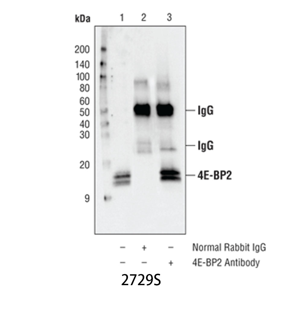 p70 S6 Kinase (49D7) Rabbit mAb