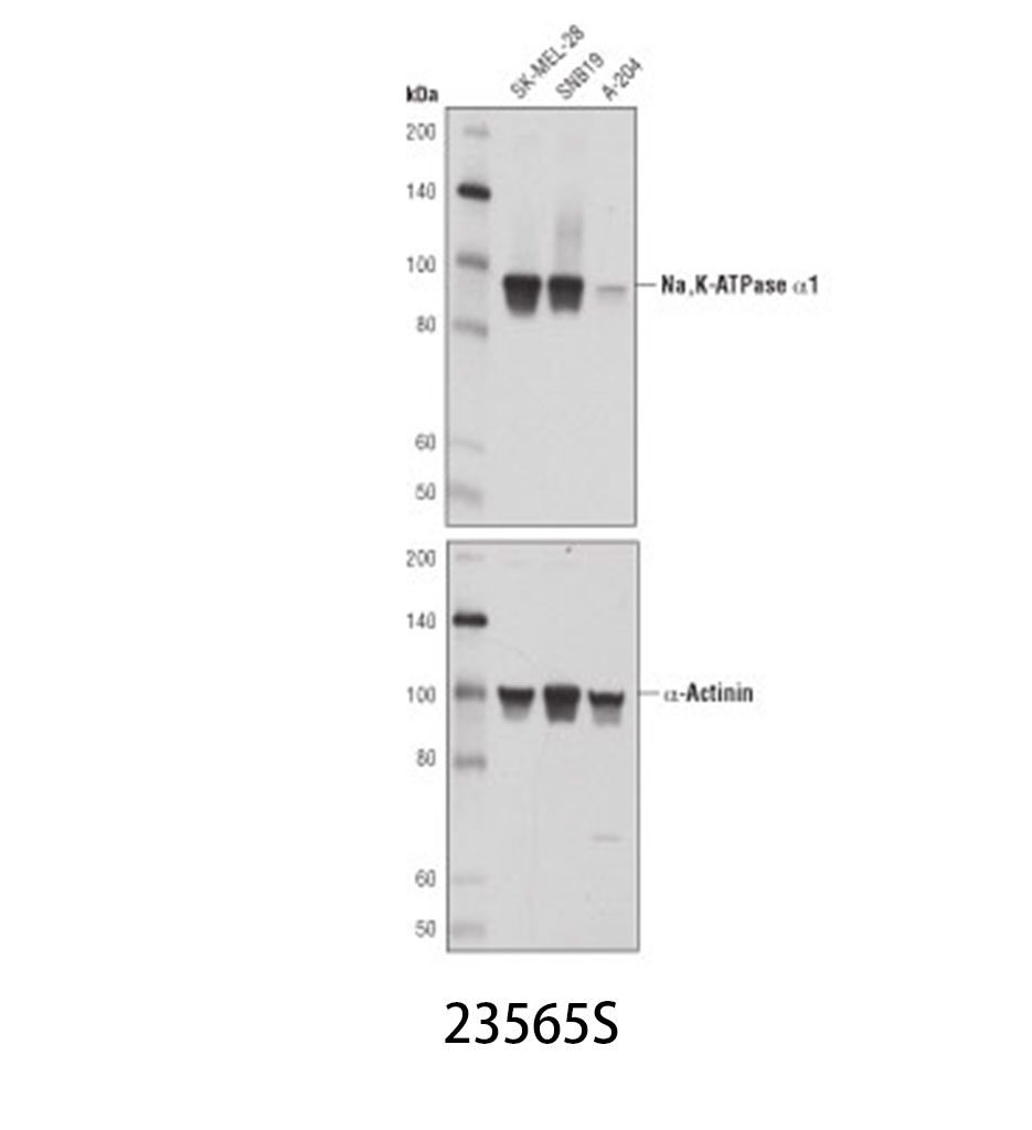 Na K-ATPase α1 (D4Y7E) Rabbit mAb