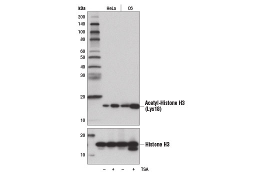 Acetyl-Histone H3 Antibody Sampler Kit
