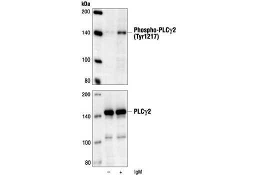 Phospho-PLCγ2 (Tyr1217) Antibody