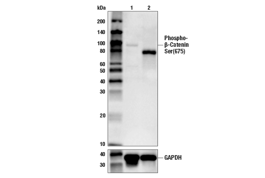 β-Catenin Antibody Sampler Kit