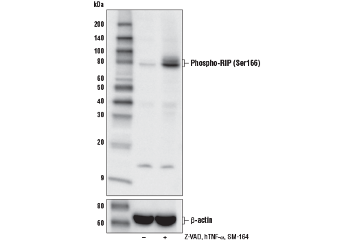 Phospho-RIP (Ser166) (D8I3A) Rabbit mAb