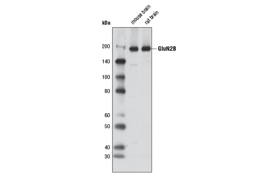 NMDA Receptor 2B (GluN2B) (D8E10) Rabbit mAb