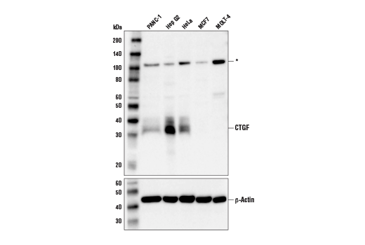 CTGF (D8Z8U) Rabbit mAb