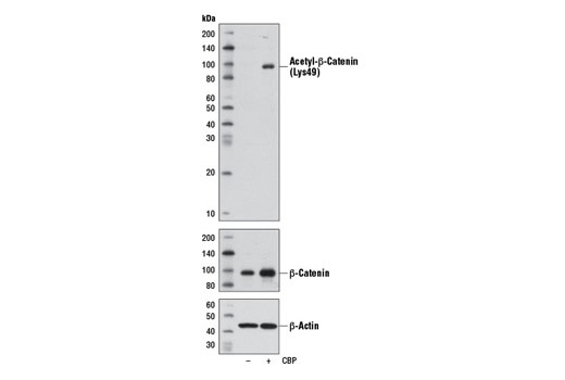 Acetyl-β-Catenin (Lys49) (D7C2) Rabbit mAb