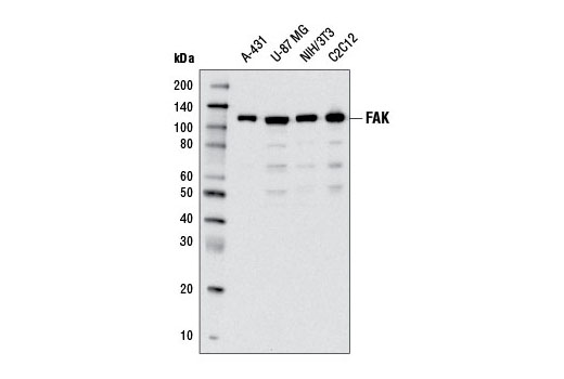 FAK (D2R2E) Rabbit mAb