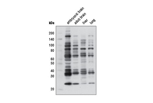 Mono-Methyl Arginine (R*GG) (D5A12) Rabbit mAb
