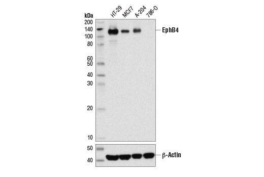 EphB4 (D1C7N) Rabbit mAb