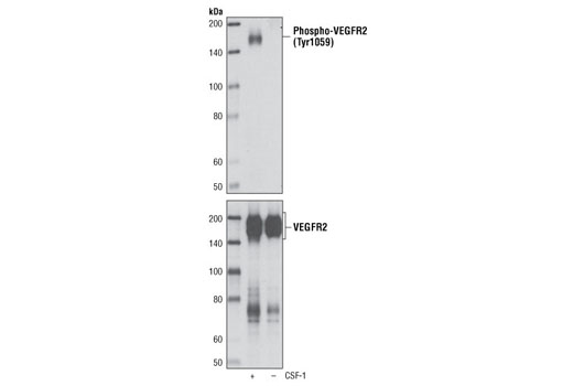 Phospho-VEGF Receptor 2 (Tyr1059) (D5A6) Rabbit mAb