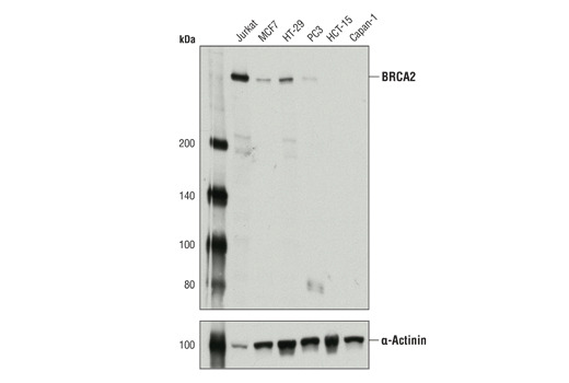 BRCA2 (D9S6V) Rabbit mAb