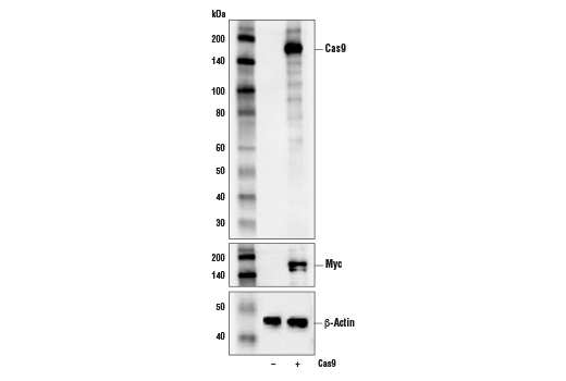 Cas9 (&lt;i&gt;S. pyogenes&lt;/i&gt;) (D8Y4K) Rabbit mAb