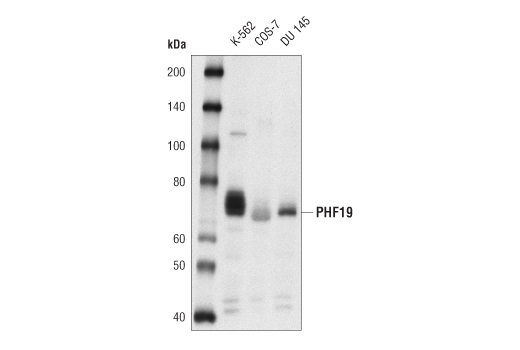 PHF19 Antibody
