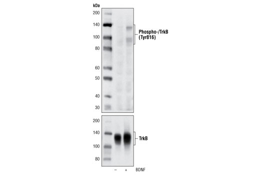 Phospho-TrkA (Tyr785)/TrkB (Tyr816) (C67C8) Rabbit mAb