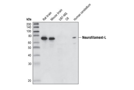 Neurofilament-L (DA2) Mouse mAb