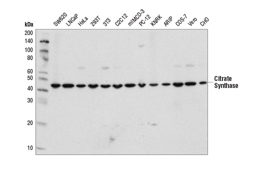 Citrate Synthase (D7V8B) Rabbit mAb