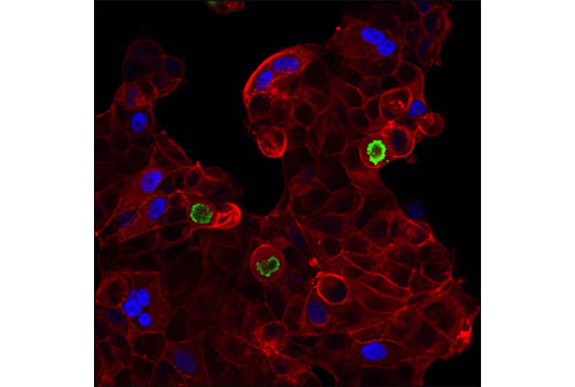 p21 Waf1/Cip1 (12D1) Rabbit mAb (Alexa Fluor 647 Conjugate)