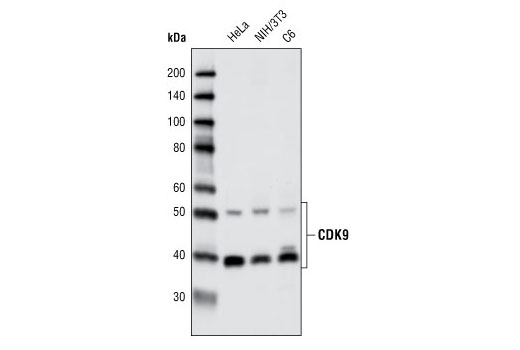 CDK9 (C12F7) Rabbit mAb