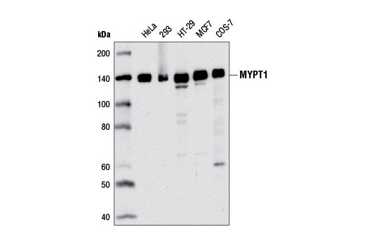 MYPT1 (D6C1) Rabbit mAb