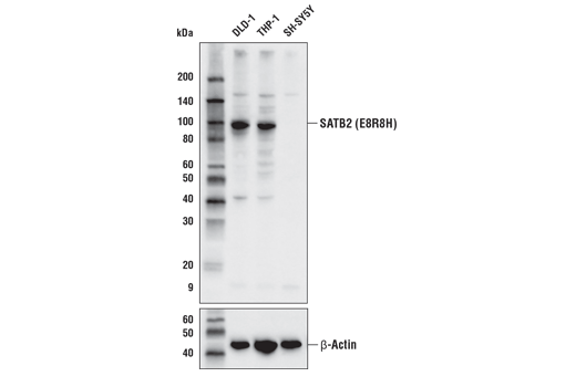 SATB2 (E8R8H) Rabbit mAb