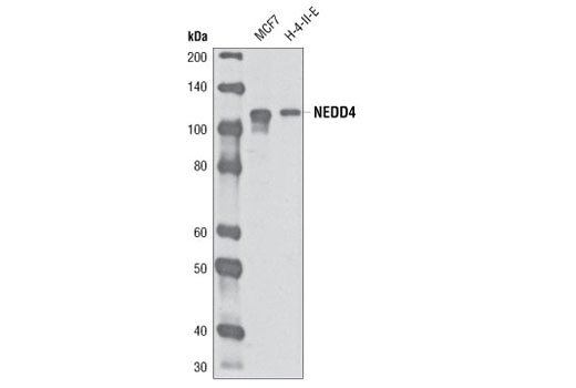 NEDD4 (D82F4) Rabbit mAb