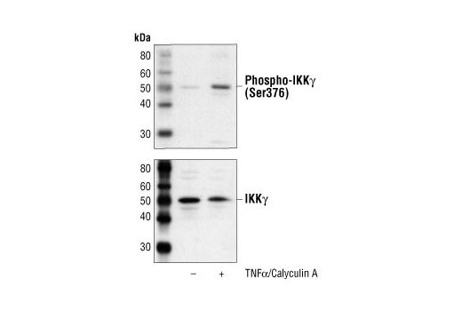 Phospho-IKKγ (Ser376) Antibody
