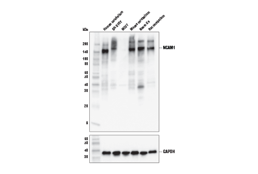 NCAM1 (CD56) (E7X9M) XP Rabbit mAb