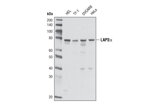 LAP2α (3A3) Mouse mAb