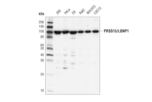 PRSS15/LONP1 (D8W1J) Rabbit mAb
