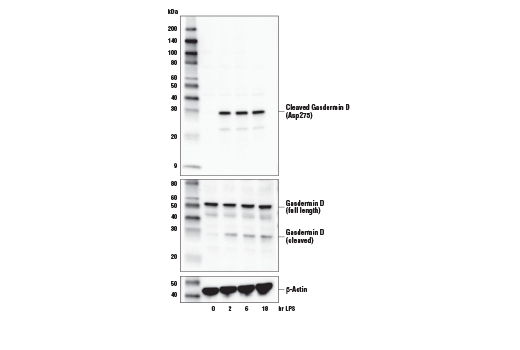 Human Reactive Cell Death and Autophagy Antibody Sampler Kit