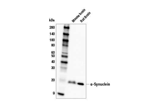 alpha-Synuclein (E4U2F) Rabbit mAb