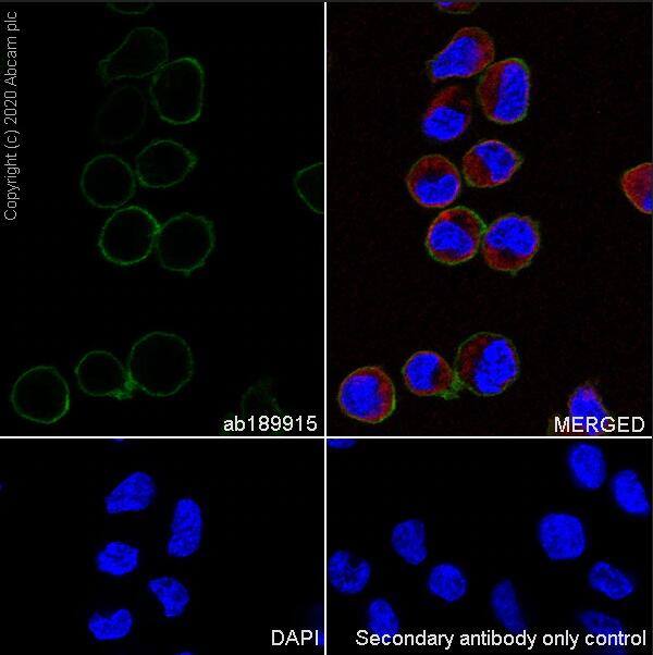 Anti-CD163 antibody [EPR19518]
