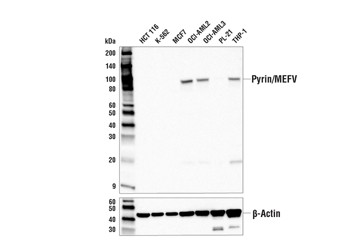 Pyrin/MEFV (E2E8U) Rabbit mAb