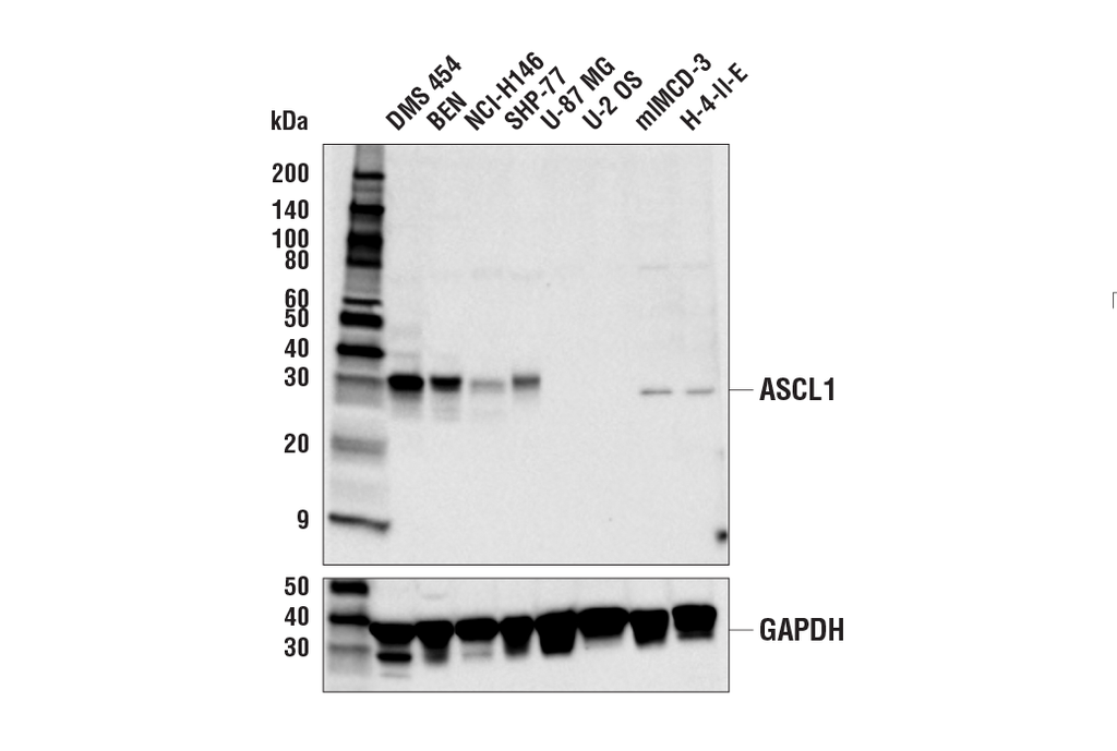 ASCL1 (E6Y1B) Rabbit Monoclonal Antibody