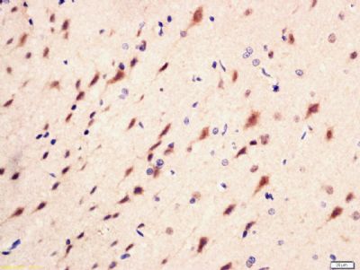 磷酸化磷脂酰肌醇激酶/PI3 Kinase P85a/r抗体