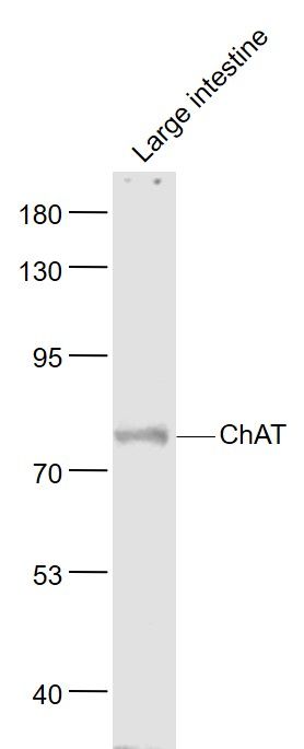 ChAT胆碱乙酰转移酶抗体