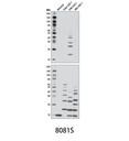 K48-linkage Specific Polyubiquitin (D9D5) Rabbit mAb