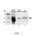 Parkin Antibody
