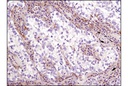 LKB1 (D60C5F10) Rabbit mAb (IHC Formulated)